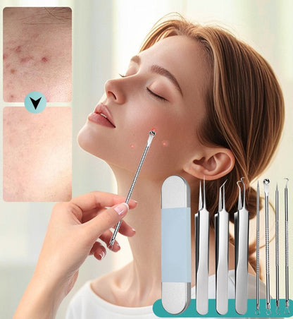 50% OFF🔥Stainless Steel Blackhead Remover Tool Kit