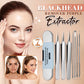 50% OFF🔥Stainless Steel Blackhead Remover Tool Kit